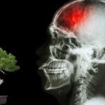 O Uso de Bonsai na Reabilitação de Pacientes Pós-AVC: Terapia Natural para Corpo e Mente
