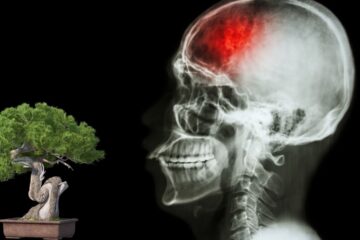 O Uso de Bonsai na Reabilitação de Pacientes Pós-AVC: Terapia Natural para Corpo e Mente