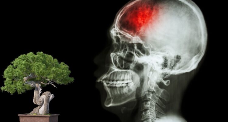 O Uso de Bonsai na Reabilitação de Pacientes Pós-AVC: Terapia Natural para Corpo e Mente